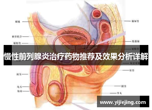 慢性前列腺炎治疗药物推荐及效果分析详解